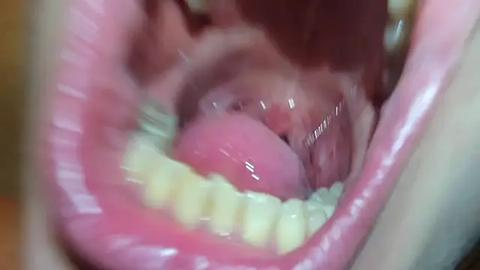 Media: Close-up video of an open mouth with visible pink tongue, saliva, and yellowish teeth, taken from a low angle, focusing on the inner oral cavity.