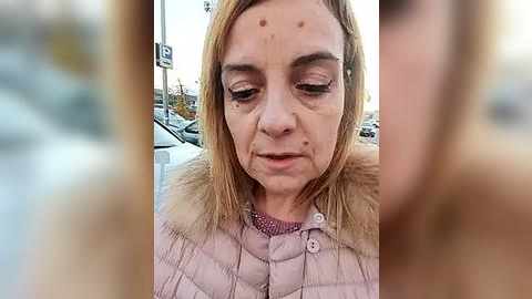 Media: Video of a Caucasian woman with light skin and shoulder-length blonde hair, wearing a pink puffer jacket with fur trim, standing in a snowy parking lot, showing visible bruises on her face.